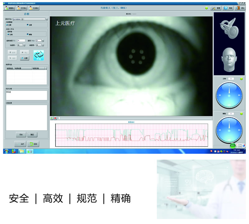 与手法复位比较的优势 与手法复位比较的优势
